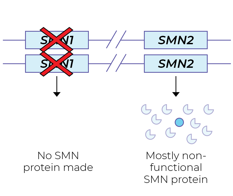 SMA patient.